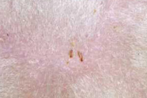 Pelslus Foto: Ola Nafstad