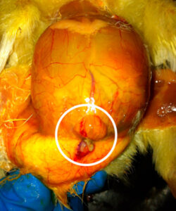 Betent navle og omliggende vev.